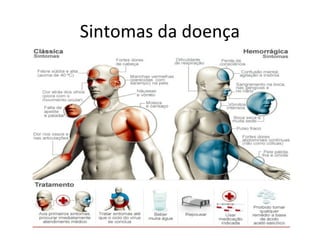 Sintomas da doença
 