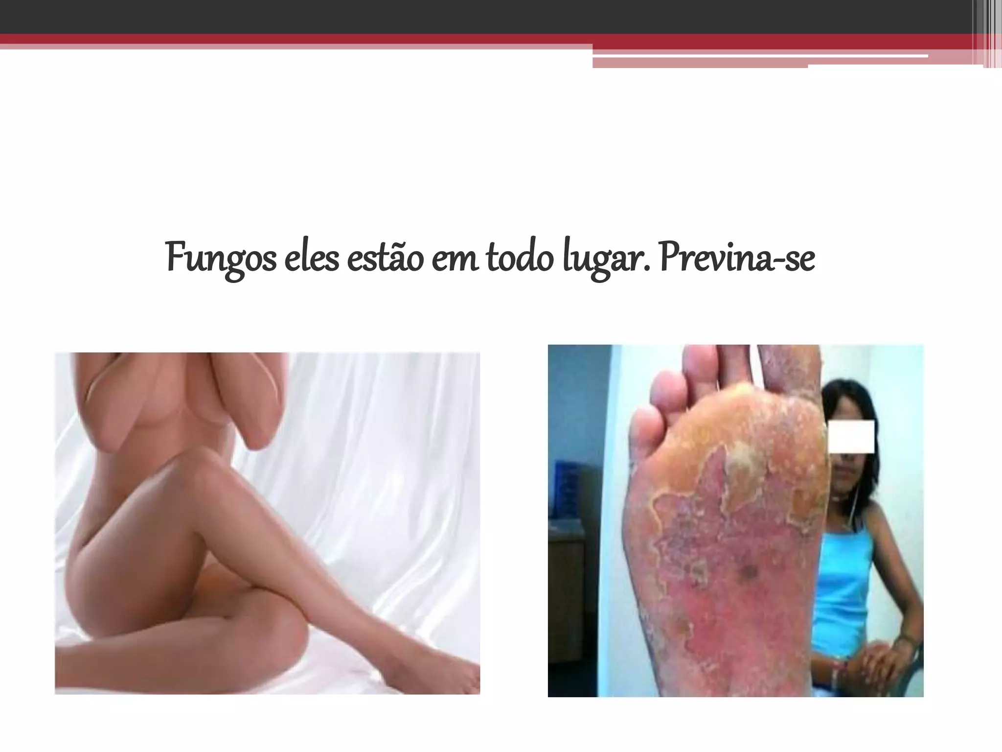 Fungos eles estão em todo lugar. Previna-se
 