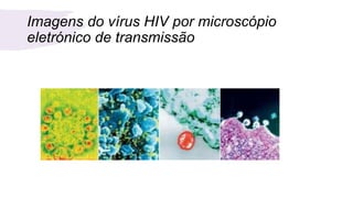 Imagens do vírus HIV por microscópio
eletrónico de transmissão
 