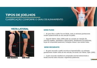 TIPOS DE JOELHOS
CLASSIFICAÇÃO CONFORME O GRAU DE ALINHAMENTO
VISTALATERAL
GENO RECURVATO
 No geno recurvato o joelho encontra-se hiperestendido e os estresses
gravitacionais incidem antes do eixo articular, de acordo com Palmer; Epler (2000).
 O geno recurvato resultará em compressão anormal anteriormente e
tensão anormal sobre músculos e ligamentos posteriores.
GENO FLEXO
 No geno flexo o joelho fica em flexão, onde os estresses gravitacionais
incidem posteriormente ao eixo articular do joelho.
 Segundo Palmer; Epler (2000) pode ser causado por retração dos
músculos poplíteo, isquiotibiais e gastrocnêmio, alongamento de quadríceps,
forças de compressão posteriores, limitações ósseas e dos tecidos moles.
 