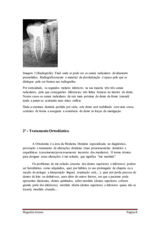 Magnólia Gomes Página 8
Imagem 3 (Radiografia) Final onde se pode ver os canais radiculares devidamente
preenchidos. Radiograficamente o material da desvitalização é opaco pelo que se
distingue pela cor branca nas radiografias.
Por curiosidade, os segundos molares inferiores na sua maioria têm três canais
radiculares, pelo que conseguimos diferencias três linhas brancas no interior do dente.
Nestes casos os canais radiculares da raiz mais próxima do dente da frente (mesial)
tende a juntar-se acabando num único orifício.
Dada a estrutura dentária perdida por cárie, este dente será reabilitado com uma coroa
cerâmica de forma a assegurar a resistência do dente às forças da mastigação.
2º - Tratamento Ortodôntico
A Ortodontia é a área da Medicina Dentária especializada no diagnóstico,
prevenção e tratamento de alterações dentárias (mau posicionamento dentário) e
esqueléticas (crescimento/posicionamento incorreto dos maxilares). O termo técnico
para designar essas alterações é má oclusão, que significa “má mordida”.
Os problemas de má oclusão (encaixe dos dentes superiores e inferiores) podem
ser hereditários como adquiridos, quer por hábitos (o uso prolongado de chupeta ou a
sucção do polegar, a interposição lingual, respiração oral,…), quer por perda precoce de
dentes de leite ou definitivos, para além de outros fatores, em que o paciente pode
apresentar diastemas, dentes apinhados, sobre mordida (dentes superiores cobrem
grande parte dos inferiores), mordida aberta (dentes superiores e inferiores quase não se
tocam), mordida cruzada,…
 