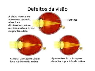 Defeitos da visão 