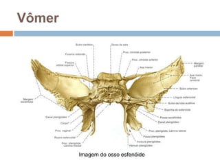 Vômer
Imagem do osso esfenóide
 