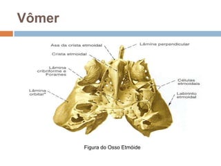 Vômer
Figura do Osso Etmóide
 