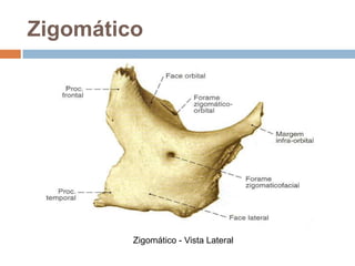 Zigomático
Zigomático - Vista Lateral
 