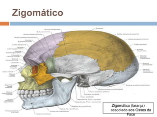 Zigomático
Zigomático (laranja)
associado aos Ossos da
Face
 