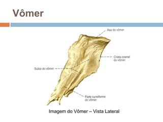 Vômer
Imagem do Vômer – Vista Lateral
 