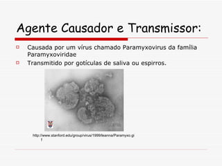 Agente Causador e Transmissor: Causada por um vírus chamado Paramyxovirus da família Paramyxoviridae Transmitido por gotículas de saliva ou espirros.  http://www.stanford.edu/group/virus/1999/leanna/Paramyxo.gif 