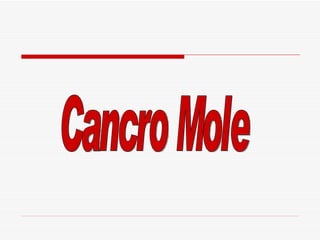 Cancro Mole 
