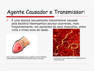 Agente Causador e Transmissor: É uma doença sexualmente transmissível causada pela bactéria  Haemophilus ducreyi  ocorrendo, mais freqüentemente, em pacientes do sexo masculino, entre vinte e trinta anos de idade.  Fonte: http://4.bp.blogspot.com/_uQCZRi1uLo8/Sv72BQXW-zI/AAAAAAAAAH8/fXNWOyX5TRQ/s320/cancro_mole.jpg Fonte:http://www.wadsworth.org/databank/hirez/hechemy2.gif 