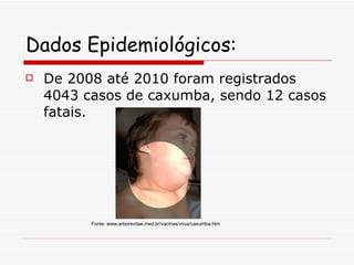 Dados Epidemiológicos: De 2008 até 2010 foram registrados 4043 casos de caxumba, sendo 12 casos fatais. Fonte: www.arborevitae.med.br/vacinas/virus/caxumba.htm 