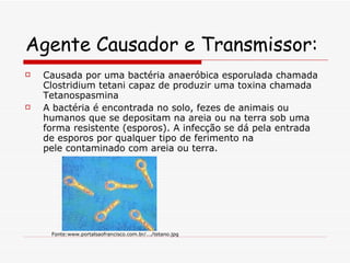 Agente Causador e Transmissor: Causada por uma bactéria anaeróbica esporulada chamada Clostridium tetani capaz de produzir uma toxina chamada Tetanospasmina A bactéria é encontrada no solo, fezes de animais ou humanos que se depositam na areia ou na terra sob uma forma resistente (esporos). A infecção se dá pela entrada de esporos por qualquer tipo de ferimento na pele contaminado com areia ou terra. Fonte:www.portalsaofrancisco.com.br/.../tetano.jpg   