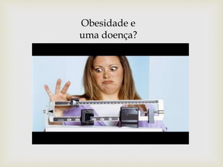 Obesidade e
uma doença?
 