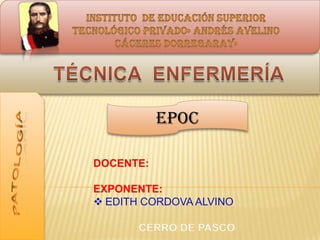 EPOC
DOCENTE:
EXPONENTE:
 EDITH CORDOVA ALVINO
 