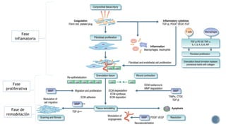 Fase
inflamatoria
Fase
proliferativa
Fase de
remodelación
 