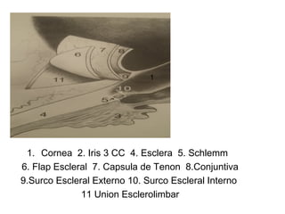 1. Cornea 2. Iris 3 CC 4. Esclera 5. Schlemm
6. Flap Escleral 7. Capsula de Tenon 8.Conjuntiva
9.Surco Escleral Externo 10. Surco Escleral Interno
11 Union Esclerolimbar
1
 