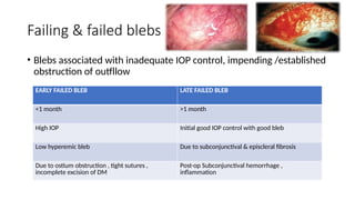 trabeculectomy for Ophthalmology residents.pptx