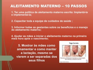 ALEITAMENTO MATERNO – 10 PASSOS
1. Ter uma política de aleitamento materno escrita: Implantá-la
e implementá-la;
2. Capacitar toda a equipe de cuidados de saúde ;
3. Informar todas as gestantes sobre os benefícios e o manejo
do aleitamento materno;
4. Ajudar as mães a iniciar o aleitamento materno na primeira
meia hora após o nascimento;
5. Mostrar às mães como
amamentar e como manter
a lactação, mesmo se
vierem a ser separadas dos
seus filhos
 