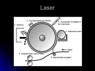 Laser 