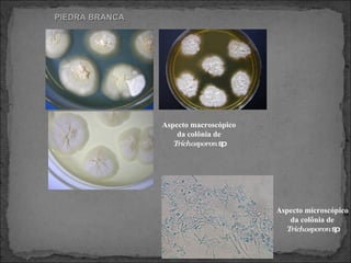 PIEDRA BRANCA Aspecto macroscópico da colônia de  Trichosporon  sp Aspecto microscópico da colônia de  Trichosporon  sp 