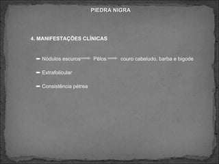 PIEDRA NIGRA 4. MANIFESTAÇÕES CLÍNICAS    Nódulos escuros  Pêlos  couro cabeludo, barba e bigode     Extrafolicular     Consistência pétrea  