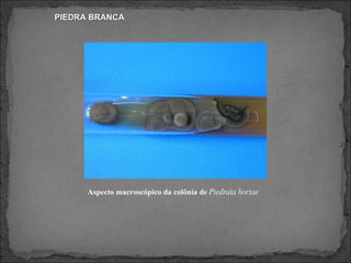 PIEDRA BRANCA Aspecto macroscópico da colônia de  Piedraia hortae   