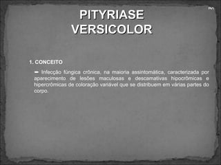 PITYRIASE VERSICOLOR PV1 1. CONCEITO    Infecção fúngica crônica, na maioria assintomática, caracterizada por aparecimento de lesões maculosas e descamativas hipocrômicas e hipercrômicas de coloração variável que se distribuem em várias partes do corpo. 