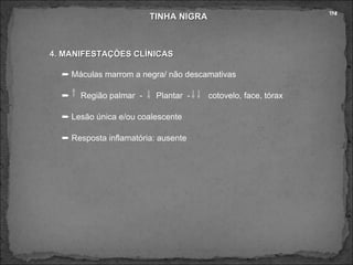 TINHA NIGRA 4. MANIFESTAÇÕES CLÍNICAS    Máculas marrom a negra/ não descamativas    Região palmar  -  Plantar  -  cotovelo, face, tórax     Lesão única e/ou coalescente     Resposta inflamatória: ausente  TN! 