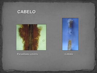 CABELO Parasitismo ectótrix Colônia 