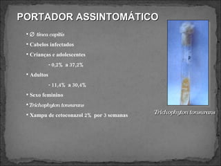    tinea capitis Cabelos infectados Crianças e adolescentes - 0,2% a 37,2% Adultos - 11,4% a 30,4% Sexo feminino Trichophyton tonsurans Xampu de  cetoconazol 2% por 3 semanas PORTADOR ASSINTOMÁTICO Trichophyton tonsurans 