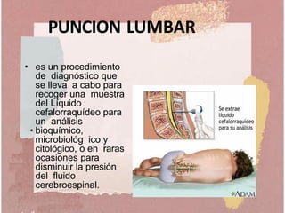 PUNCION LUMBAR
• es un procedimiento
de diagnóstico que
se lleva a cabo para
recoger una muestra
del Líquido
cefalorraquídeo para
un análisis
• bioquímico,
microbiológ ico y
citológico, o en raras
ocasiones para
disminuir la presión
del fluido
cerebroespinal.
 