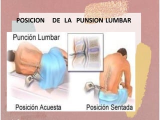POSICION DE LA PUNSION LUMBAR
 