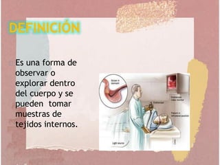 Es una forma de
observar o
explorar dentro
del cuerpo y se
pueden tomar
muestras de
tejidos internos.
 