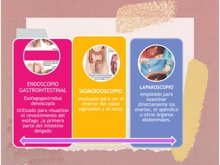 ENDOSCOPIO
GASTROINTESTINAL
Esofagogastroduo
denoscopia
Utilizado para visualizar
el revestimiento del
esófago ,la primera
parte del intestino
delgado
SIGMOIDOSCOPIO
empleado para ver el
interior del colon
sigmoideo y el recto
LAPAROSCOPIO
empleado para
examinar
directamente los
ovarios, el apéndice
u otros órganos
abdominales.
 