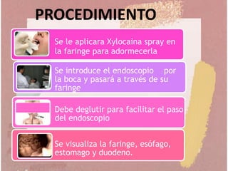 Se le aplicara Xylocaina spray en
la faringe para adormecerla
Se introduce el endoscopio por
la boca y pasará a través de su
faringe
Debe deglutir para facilitar el paso
del endoscopio
Se visualiza la faringe, esófago,
estomago y duodeno.
PROCEDIMIENTO
 