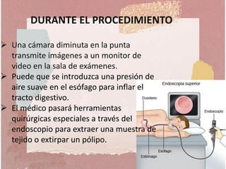 DURANTE EL PROCEDIMIENTO
 Una cámara diminuta en la punta
transmite imágenes a un monitor de
video en la sala de exámenes.
 Puede que se introduzca una presión de
aire suave en el esófago para inflar el
tracto digestivo.
 El médico pasará herramientas
quirúrgicas especiales a través del
endoscopio para extraer una muestra de
tejido o extirpar un pólipo.
 