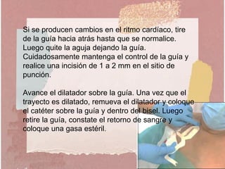 Si se producen cambios en el ritmo cardíaco, tire
de la guía hacia atrás hasta que se normalice.
Luego quite la aguja dejando la guía.
Cuidadosamente mantenga el control de la guía y
realice una incisión de 1 a 2 mm en el sitio de
punción.
Avance el dilatador sobre la guía. Una vez que el
trayecto es dilatado, remueva el dilatador y coloque
el catéter sobre la guía y dentro del bisel. Luego
retire la guía, constate el retorno de sangre y
coloque una gasa estéril.
 
