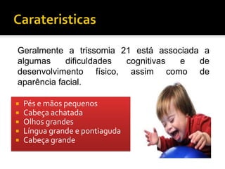 Geralmente a trissomia 21 está associada a
algumas     dificuldades cognitivas e   de
desenvolvimento físico, assim como de
aparência facial.

   Pés e mãos pequenos
   Cabeça achatada
   Olhos grandes
   Língua grande e pontiaguda
   Cabeça grande
 