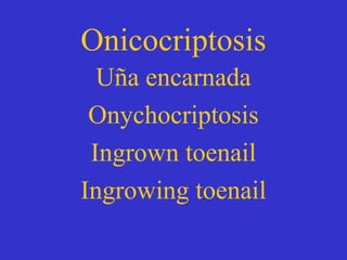 Onicocriptosis
Uña encarnada
Onychocriptosis
Ingrown toenail
Ingrowing toenail
 