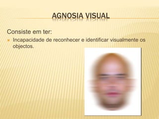 AGNOSIA VISUAL
Consiste em ter:
 Incapacidade de reconhecer e identificar visualmente os
objectos.
 