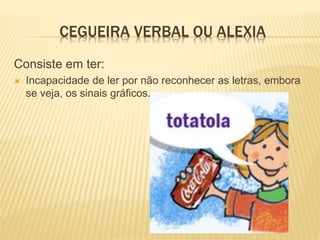 CEGUEIRA VERBAL OU ALEXIA
Consiste em ter:
 Incapacidade de ler por não reconhecer as letras, embora
se veja, os sinais gráficos.
 