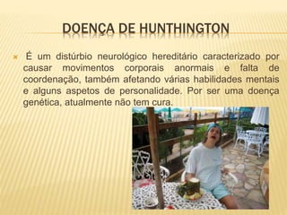 DOENÇA DE HUNTHINGTON
 É um distúrbio neurológico hereditário caracterizado por
causar movimentos corporais anormais e falta de
coordenação, também afetando várias habilidades mentais
e alguns aspetos de personalidade. Por ser uma doença
genética, atualmente não tem cura.
 