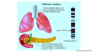 Fonte: Fisiotepia para todos
 