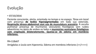 Evolução
• 07/10/2016
Paciente consciente, alerta, orientada no tempo e no espaço. Tórax em tonel
com presença de lesões hiperpigmentadas em toda sua extensão.
Respiração tóraco-abdominal com uso de musculatura acessória. À asculta
pulmonar presença de murmúrios vesiculares fisiológicos sem ruídos
adventícios no ápice de ambos os lados e murmúrios vesiculares fisiológicos
com crepitação bilateralemente. Queixa-se de edema em membros
inferiores.
PA=118x67
Amígdalas e úvula sem hiperemia. Edema em membros inferiores (++/++++)
 