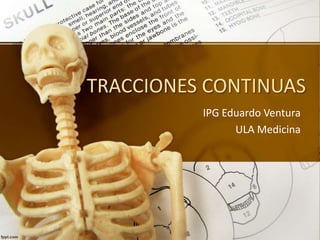 TRACCIONES CONTINUAS
IPG Eduardo Ventura
ULA Medicina
 