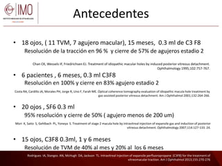Tratamientos para la tracción vítreo macular, Valera D. | PPTX
