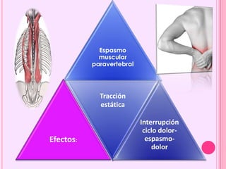 Espasmo
muscular
paravertebral
Efectos:
Tracción
estática
Interrupción
ciclo dolor-
espasmo-
dolor
 
