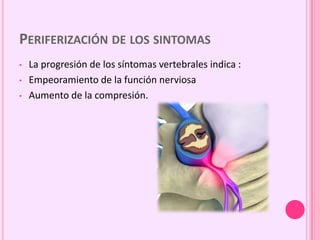 PERIFERIZACIÓN DE LOS SINTOMAS
• La progresión de los síntomas vertebrales indica :
• Empeoramiento de la función nerviosa
• Aumento de la compresión.
 