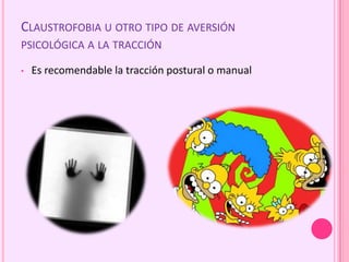 CLAUSTROFOBIA U OTRO TIPO DE AVERSIÓN
PSICOLÓGICA A LA TRACCIÓN
• Es recomendable la tracción postural o manual
 