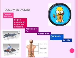 DOCUMENTACIÓN:
Tipo de
tracción.
Región
corporal en
la que fue
aplicada.
Posición del
Px.
Fuerza máx
Tiempo de
Tx.
R= al Tx
 